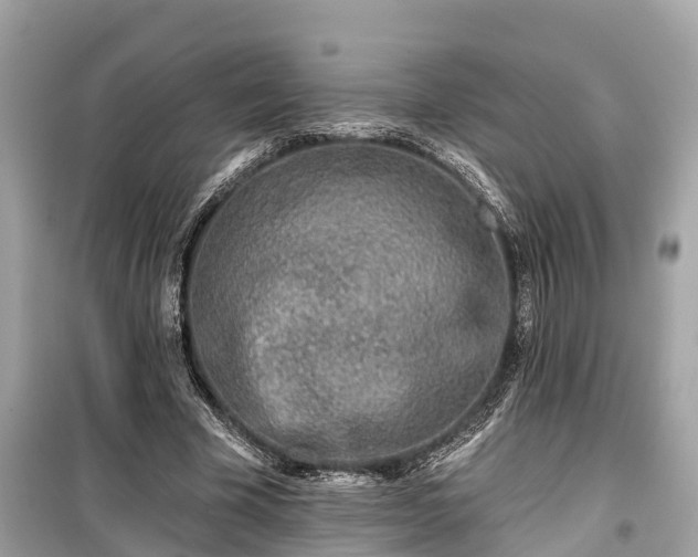 X0000099440585200805161136
