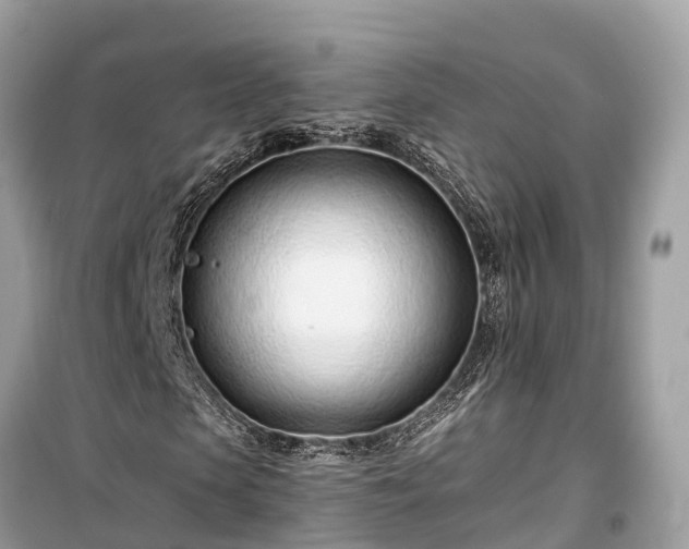 X0000099440913200805161130