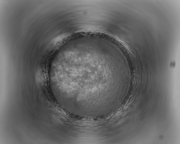 X0000099440918200805161130