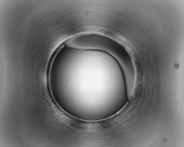 X0000099440936200805161130