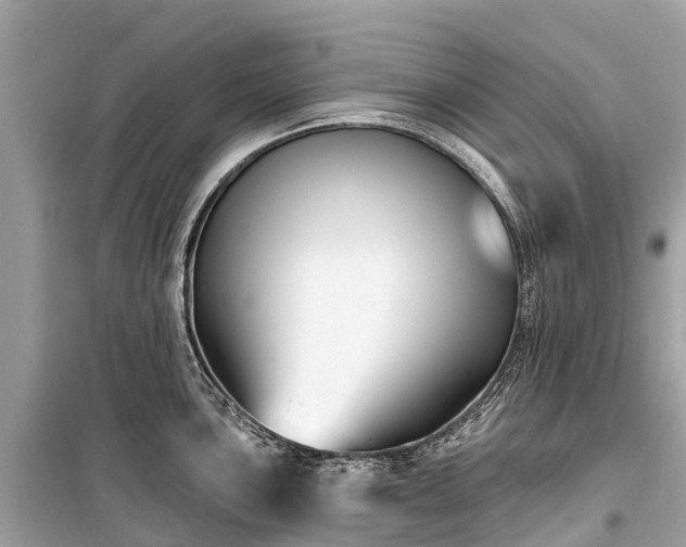 X0000099441051200805161129