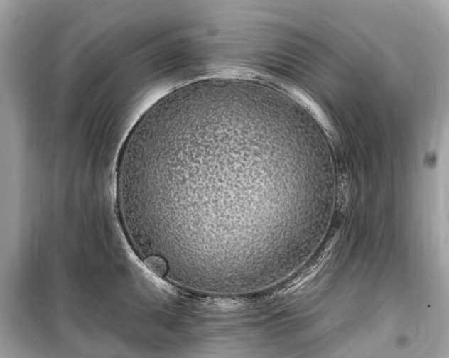 X0000099441095200805161128