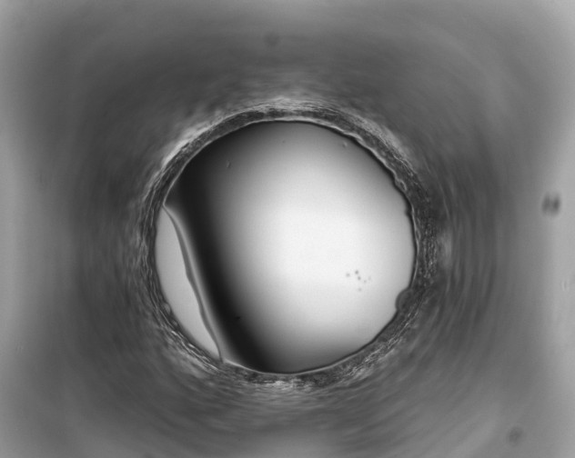 X0000099441160200805161127