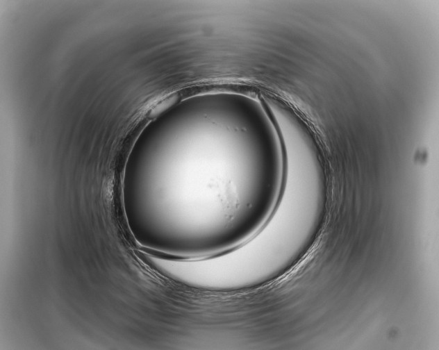 X0000099441161200805161127