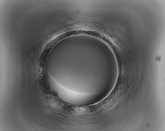 X0000099441303200805161124