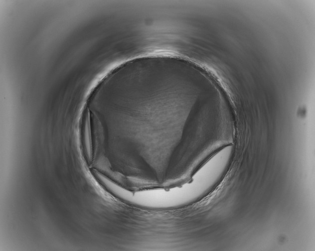 X0000099441422200805161123