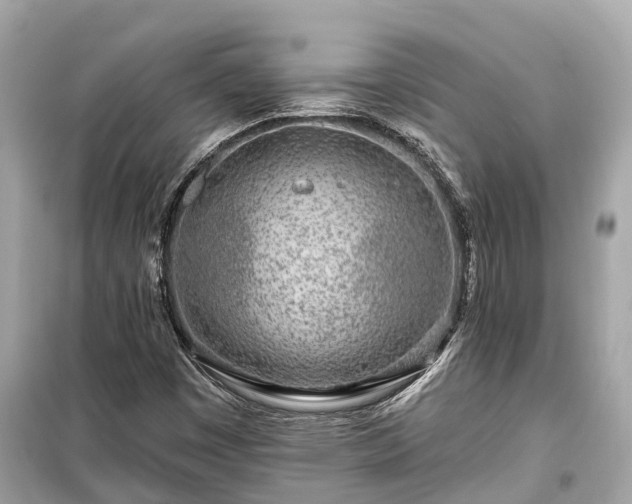 X0000099441449200805161122