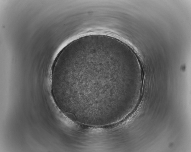X0000099441522200805161122
