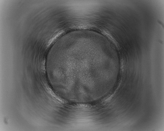 X0000099440585200805231720