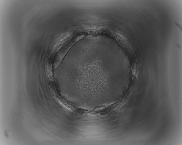 X0000099441252200805231709