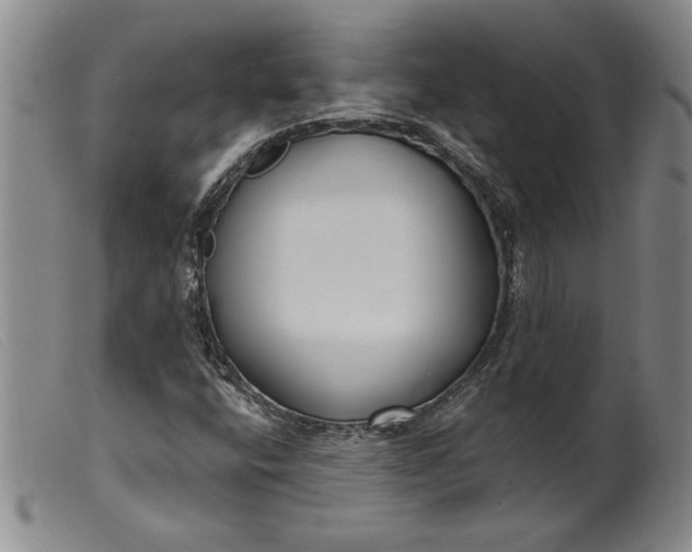 X0000099441400200805231706