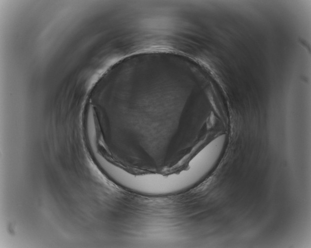 X0000099441422200805231706