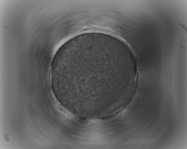 X0000099441522200805231705