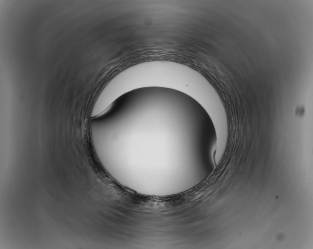 X0000099440276200805301457