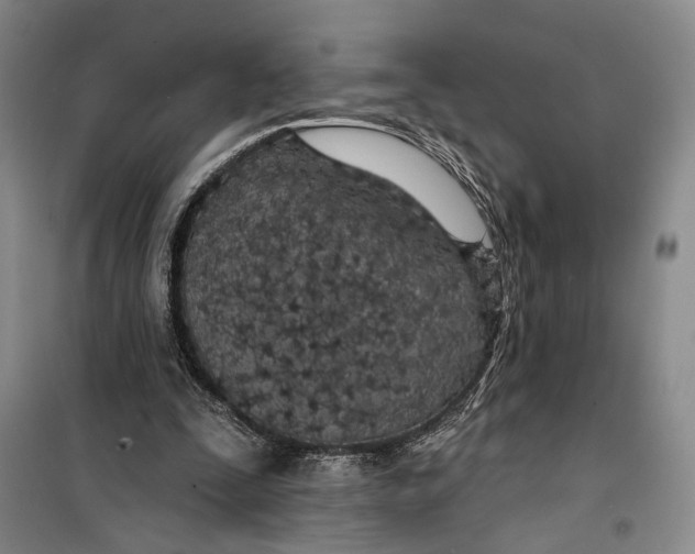 X0000099440295200805301457