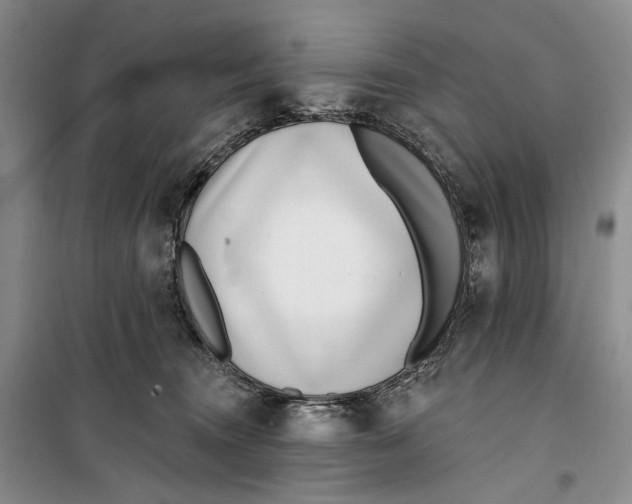 X0000099440372200805301456