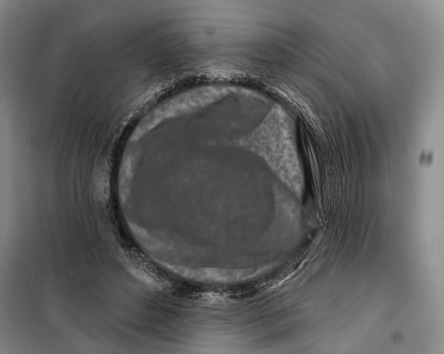 X0000099440496200805301454