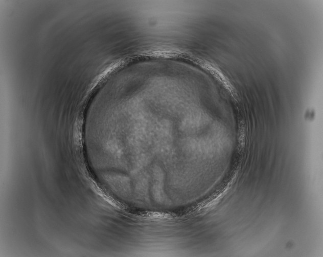 X0000099440585200805301453