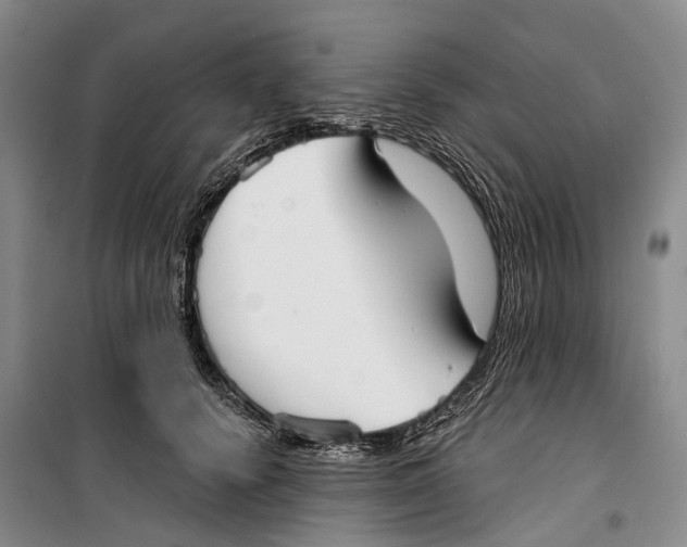 X0000099440656200805301452