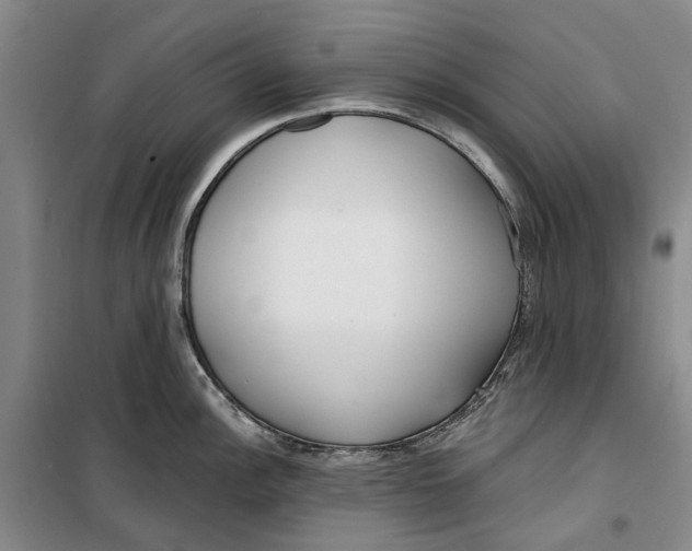 X0000099441148200805301445