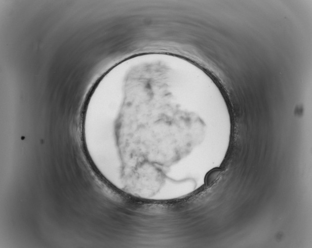 X0000099441517200805301440