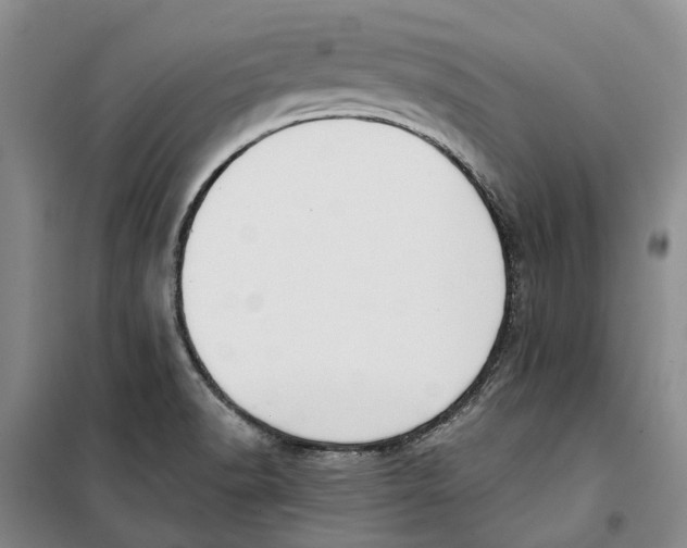 X0000099441518200805301440