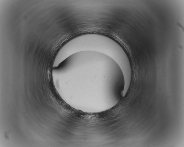 X0000099440117200806061053