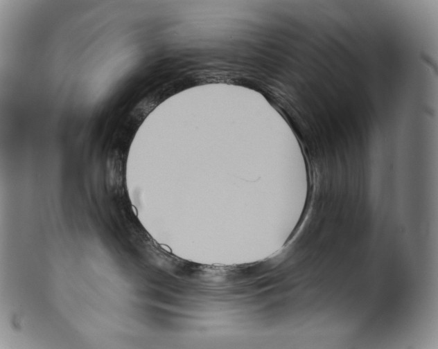 X0000099440190200806061053