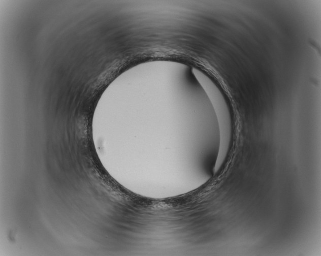 X0000099440257200806061051