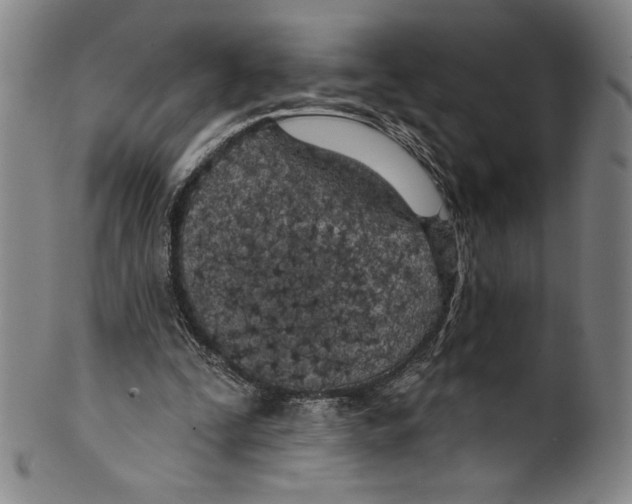 X0000099440295200806061050