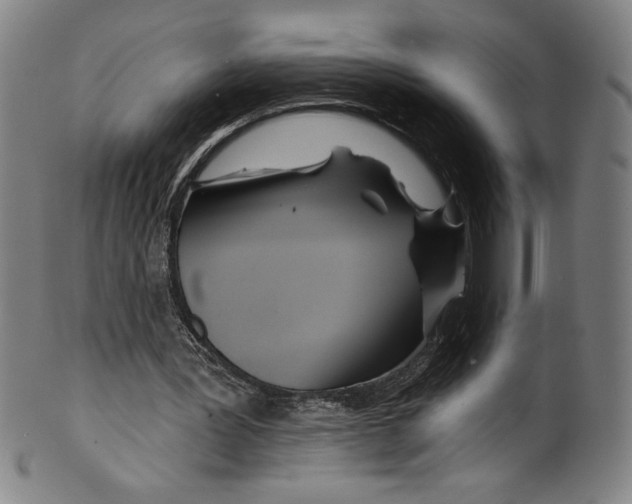 X0000099440387200806061049