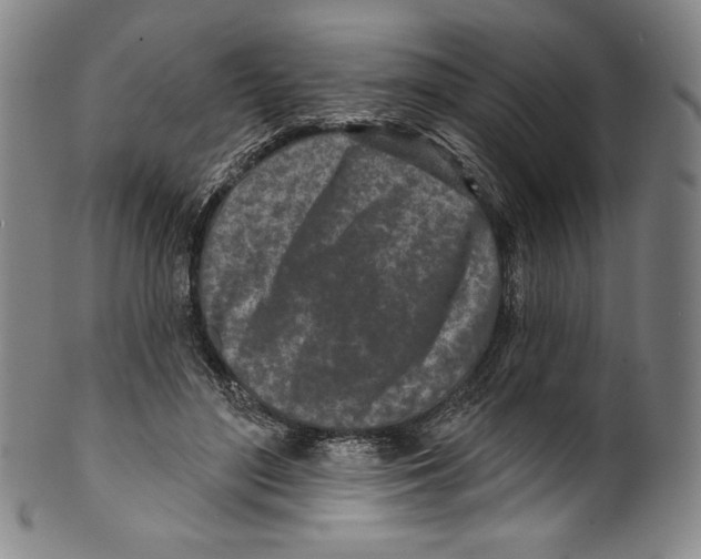 X0000099440500200806061047