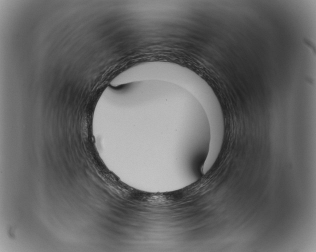 X0000099440562200806061046