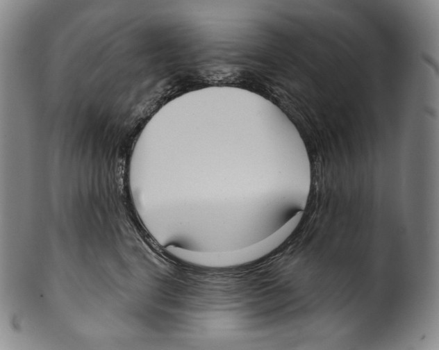 X0000099440664200806061045