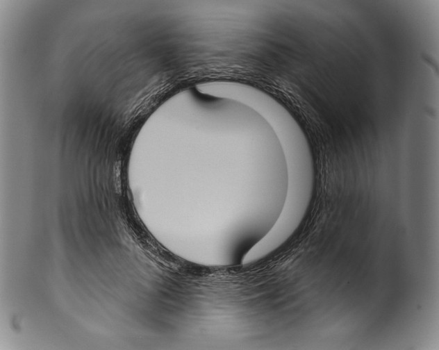 X0000099440696200806061044