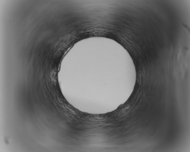 X0000099441010200806061039