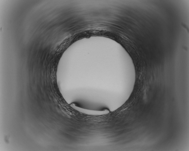 X0000099441014200806061039