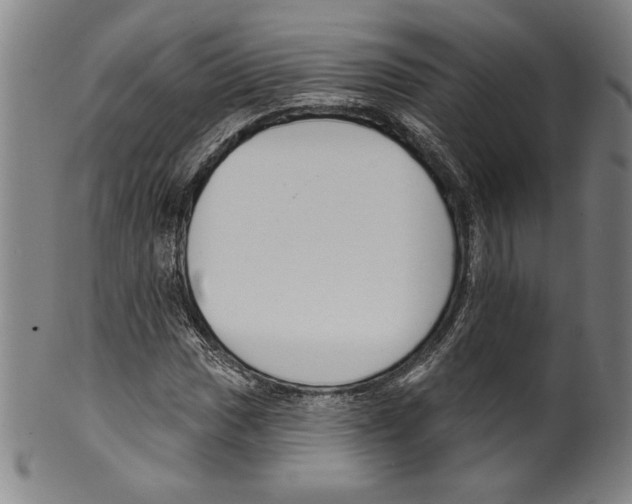 X0000099441017200806061039