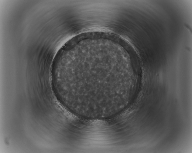 X0000099441024200806061039