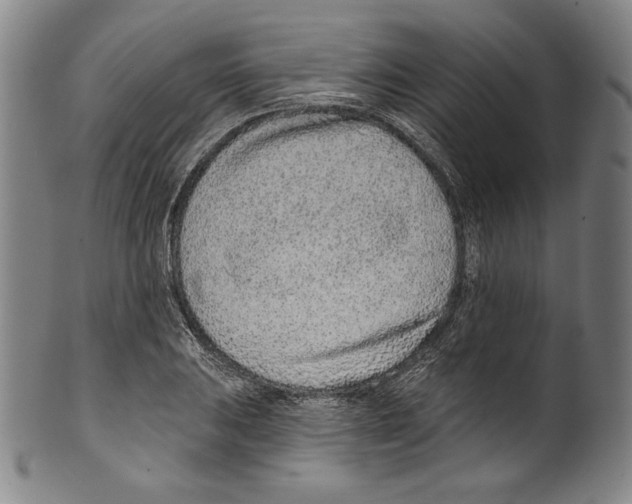 X0000099441031200806061039