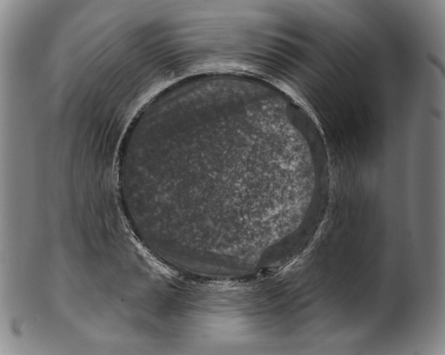 X0000099441037200806061039