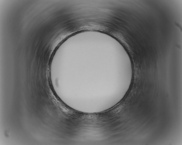 X0000099441040200806061039