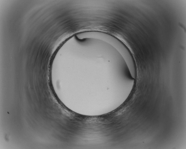 X0000099441093200806061038