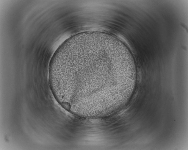 X0000099441095200806061038