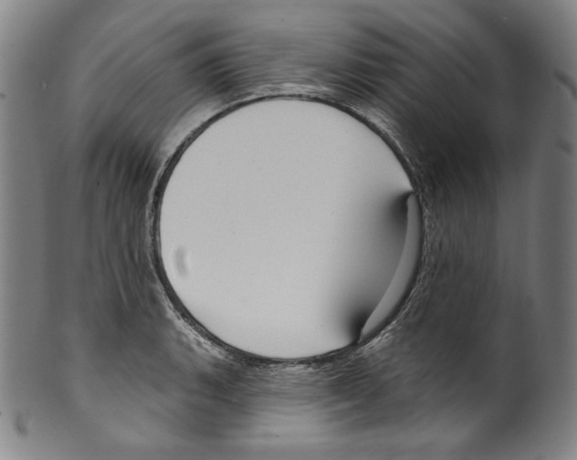 X0000099441135200806061038