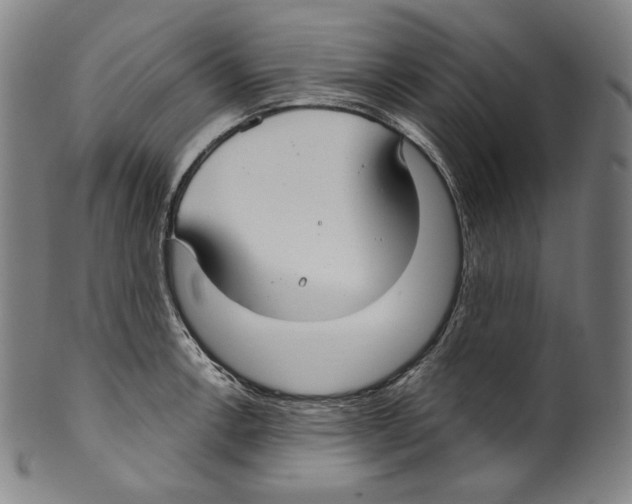 X0000099441138200806061038