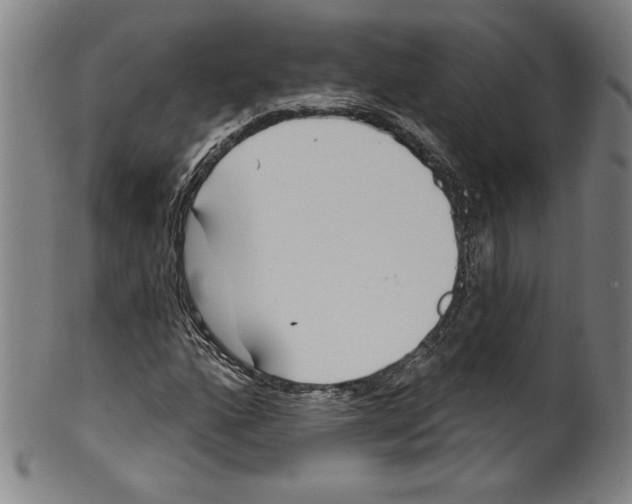 X0000099441160200806061037