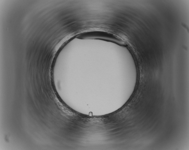 X0000099441181200806061036