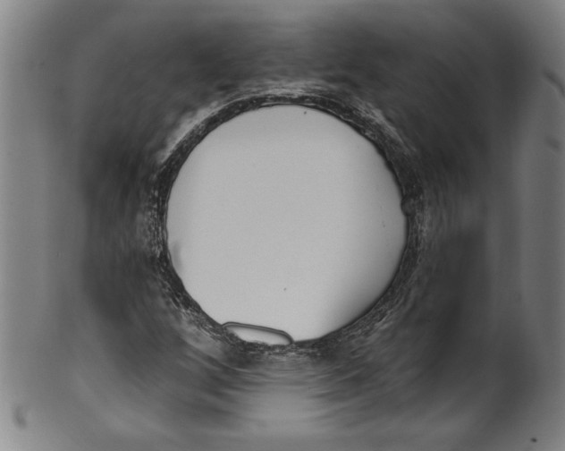 X0000099441256200806061035