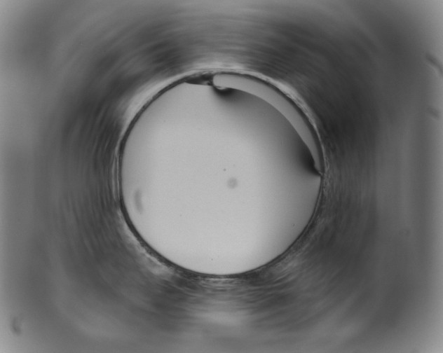 X0000099441295200806061035